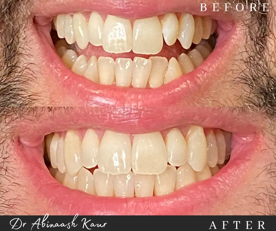 before_after_img10.png