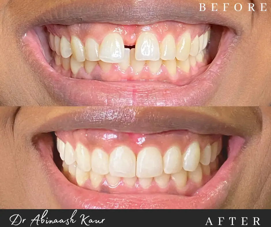 before_after_img11.png