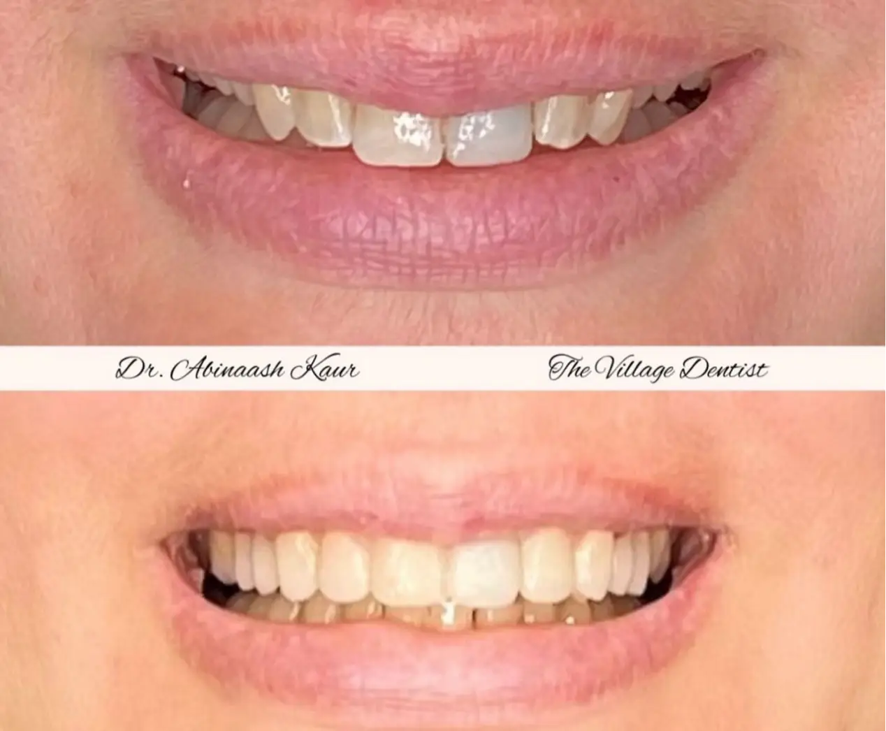 before_after_img2.png