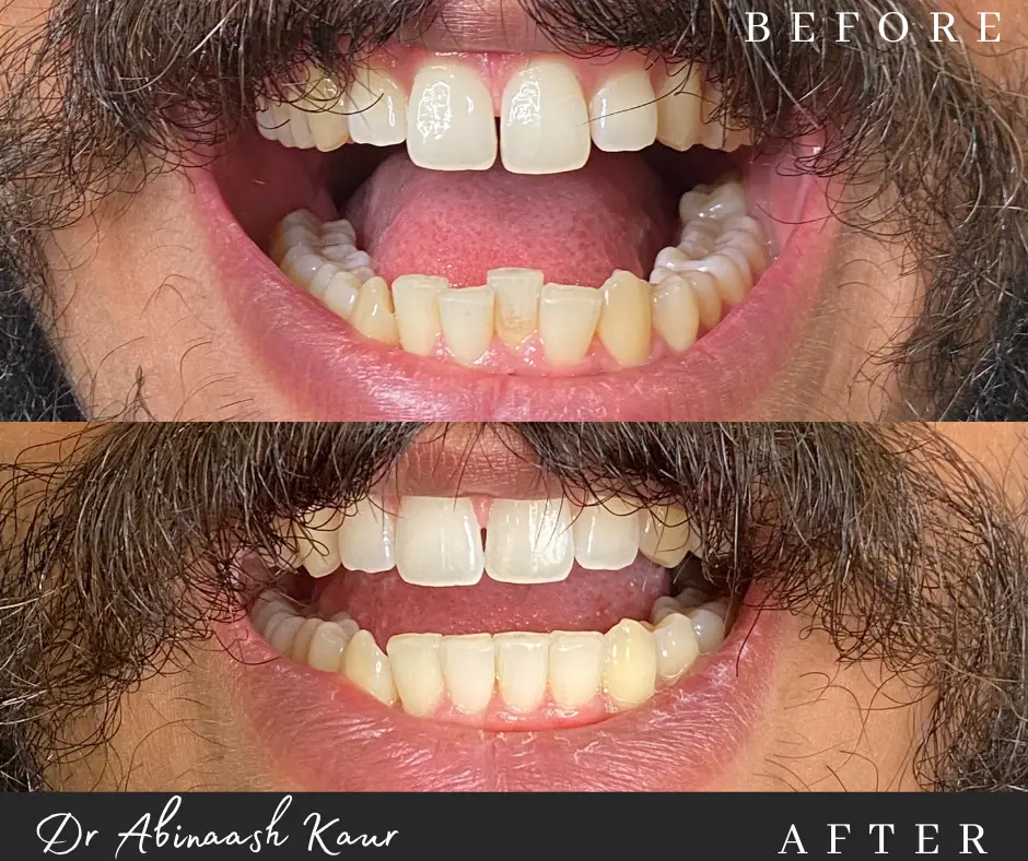 before_after_img7.png