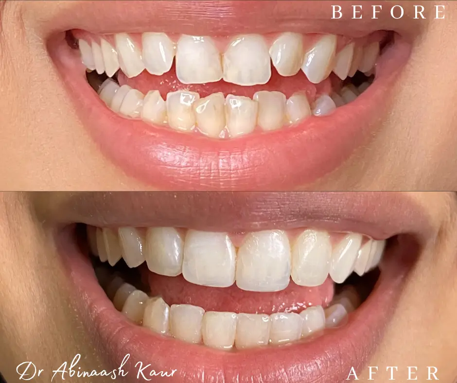 before_after_img8.png