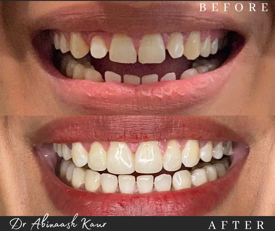 before_after_img9.png